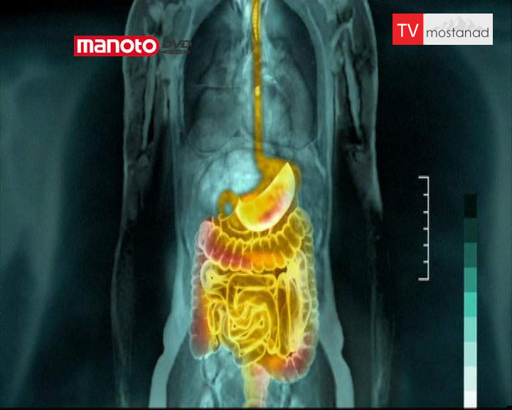 دانلود مستند دستگاه گوارش از مجموعه انسان های شگفت اور دانلود مستند دستگاه گوارش از مجموعه انسان های شگفت اور
