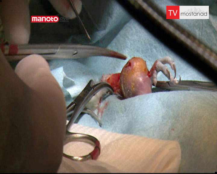 دانلود مستند جراحی مرغ عشق از مجموعه کلینیک حیوانات دانلود مستند جراحی مرغ عشق از مجموعه کلینیک حیوانات