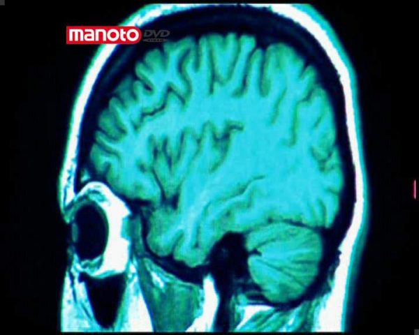 دانلود مستند اختلالات ذهنی از مجموعه اسرار مغز