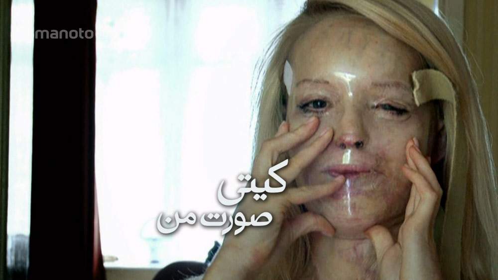 دانلود مستند کیتی; صورت من با دوبله فارسی شبکه منوتو