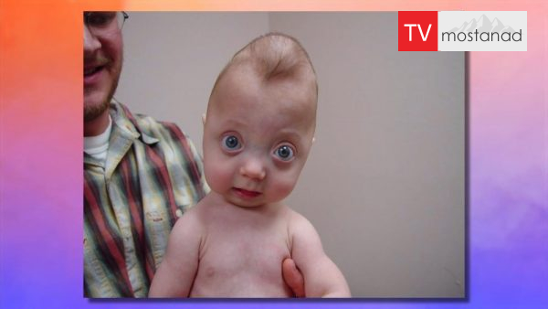 Born Different- 5 دانلود مستند زندگی زیبای من - 5 از مجموعه زندگی زیبای من با دوبله شبکه منوتو