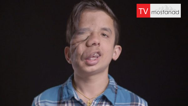 This is my face-1 دانلود مستند این صورت من است - 1 از مجموعه این صورت من است با دوبله شبکه منوتو