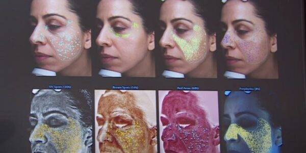 دانلود مستند تاثیر حمام آفتاب روی پوست از مجموعه ۳۷ درجه با دوبله بی بی سی فارسی